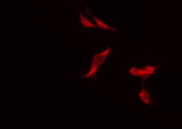 Polyclonal Rabbit anti-Human REN / Renin 1 Antibody (IF, WB)