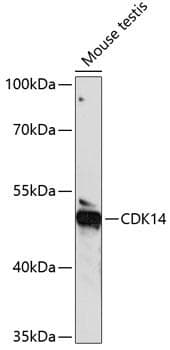 Polyclonal Rabbit anti-Human PFTK1 / CDK14 Antibody (WB)