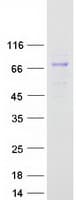 Human CYP4B1 Protein (Recombinant Myc-DDK (Flag))