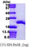 Human EEF1E1 / AIMP3 Protein (Recombinant His)