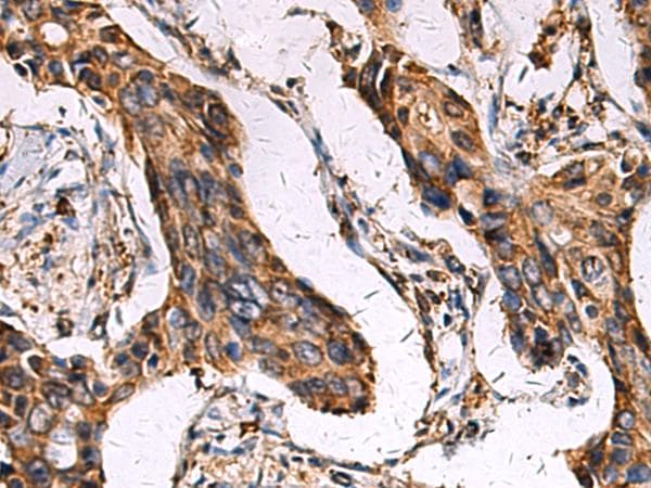 ECM1 Antibody