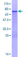 Human RILPL1 Protein (Recombinant GST)