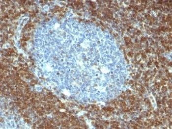 BCL2 / Bcl-2 Antibody (clone BCL2/796)