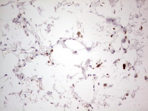 Monoclonal Mouse anti-Human NEFM / NF-M Antibody (clone OTI2G3, aa413-773, IHC, WB)