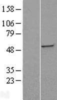 Human ST3GAL5 / GM3 Synthase Protein (Over-Expression Lysate Myc-DDK (Flag))