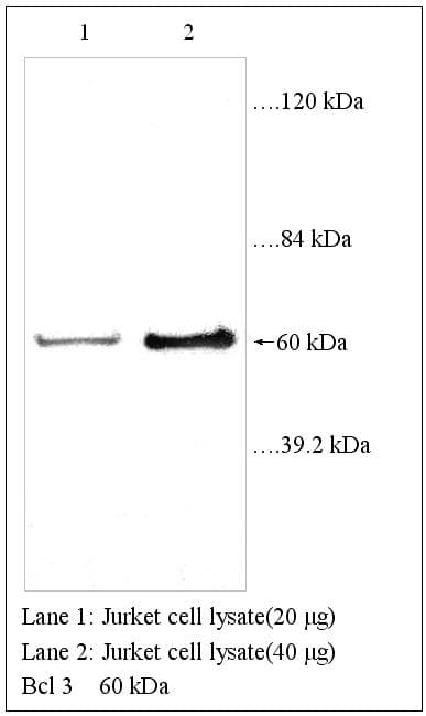 IHC-plus™ BCL3 / BCL-3 Antibody (aa2-13)