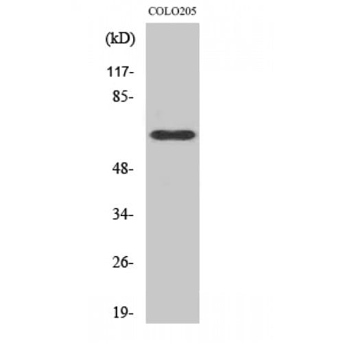 Complement C9 Antibody (150-230 aa, Internal)
