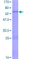 Human ZFP28 Protein (Recombinant GST)