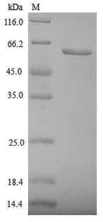Human ZP3 Protein (Recombinant 6His-SUMO, N-terminus)