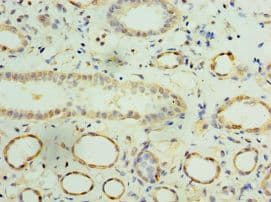 IFNA4 / Interferon Alpha 4 Antibody (aa24-189)