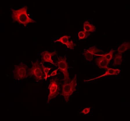 Polyclonal Rabbit anti-Human NDUFB10 Antibody (IF, WB)