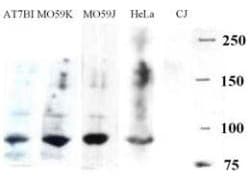 IHC-plus™ DCLRE1C / Artemis Antibody (Internal)