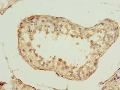 Polyclonal Rabbit anti-Human SPRTN / C1orf124 Antibody (IHC)