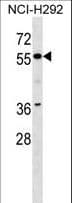 ZNF512 Antibody (aa81-110)