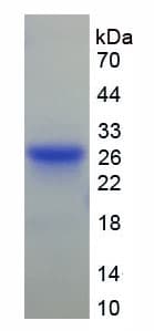Mouse GSN / Gelsolin Protein (Recombinant His-T7)