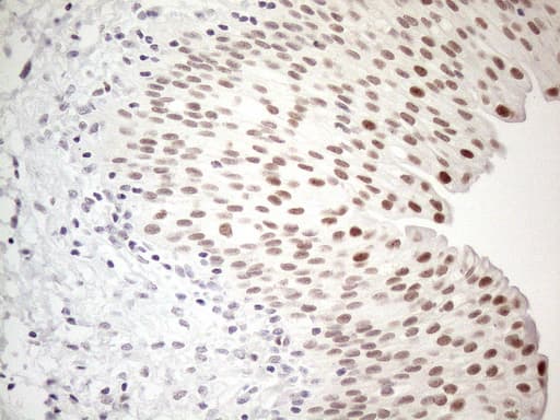 TDG / Thymine DNA Glycosylase Antibody (aa160-253, clone OTI3C11)