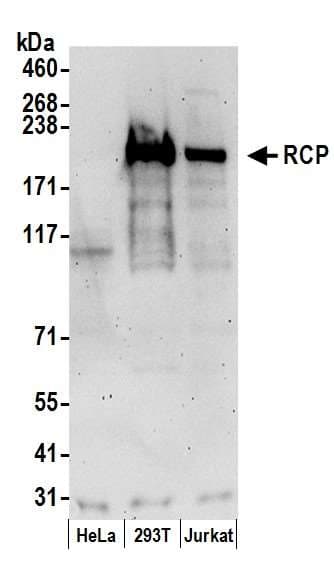 RAB11FIP1 Antibody (aa675-725)