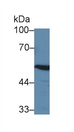 ABAT Antibody