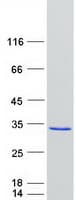 Human ZFYVE21 Protein (Recombinant Myc-DDK (Flag))