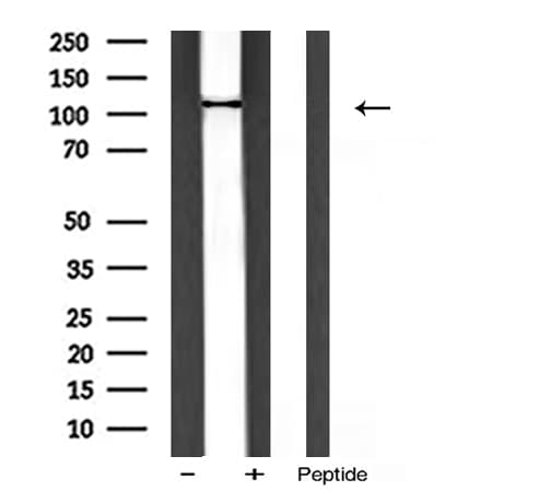 PIK3CA / PI3K Alpha Antibody