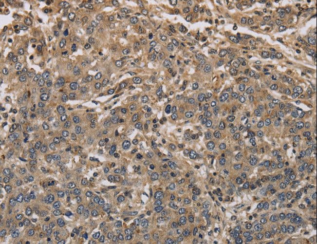 Polyclonal Rabbit anti-Human KCNA7 / Kv1.7 Antibody (IHC, WB)