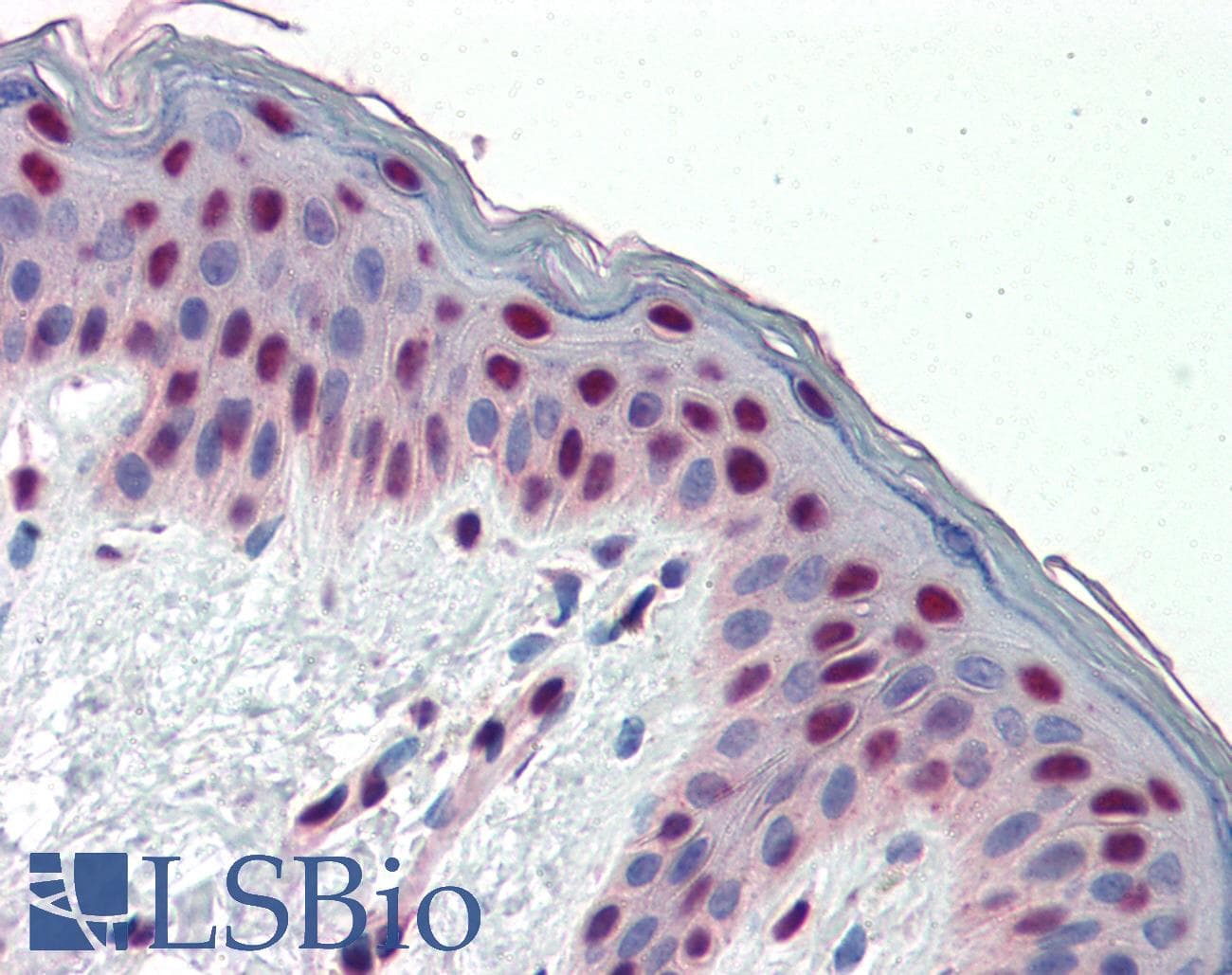 Polyclonal Rabbit anti-Human FRA-1 / FOSL1 Antibody (aa130-179, IHC, WB)