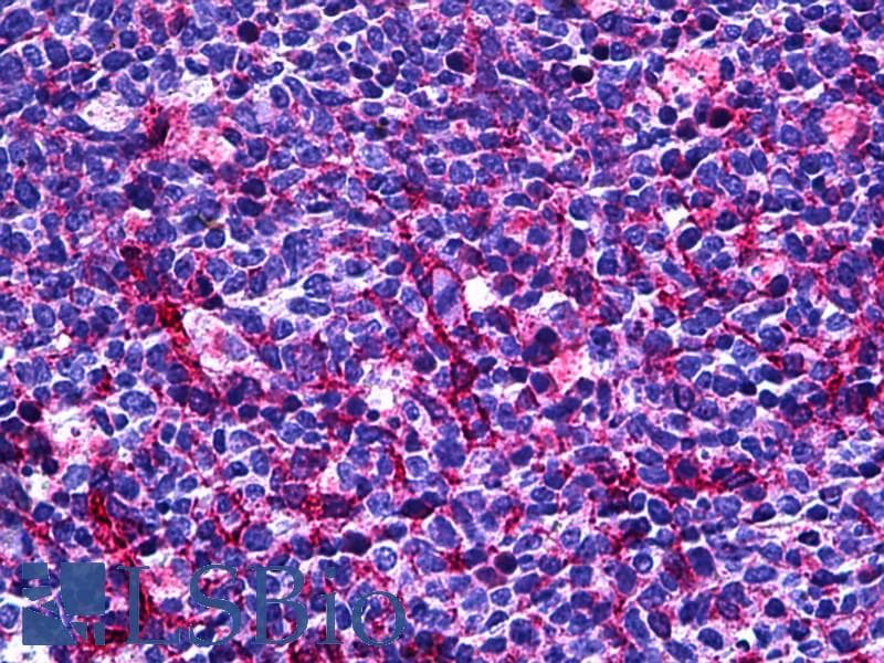 IHC-plus™ PECAM-1 / CD31 Antibody (aa686-735)
