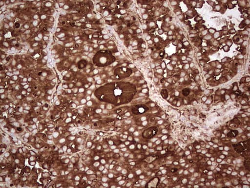 TG / Thyroglobulin Antibody (aa20-358, clone OTI8D5)