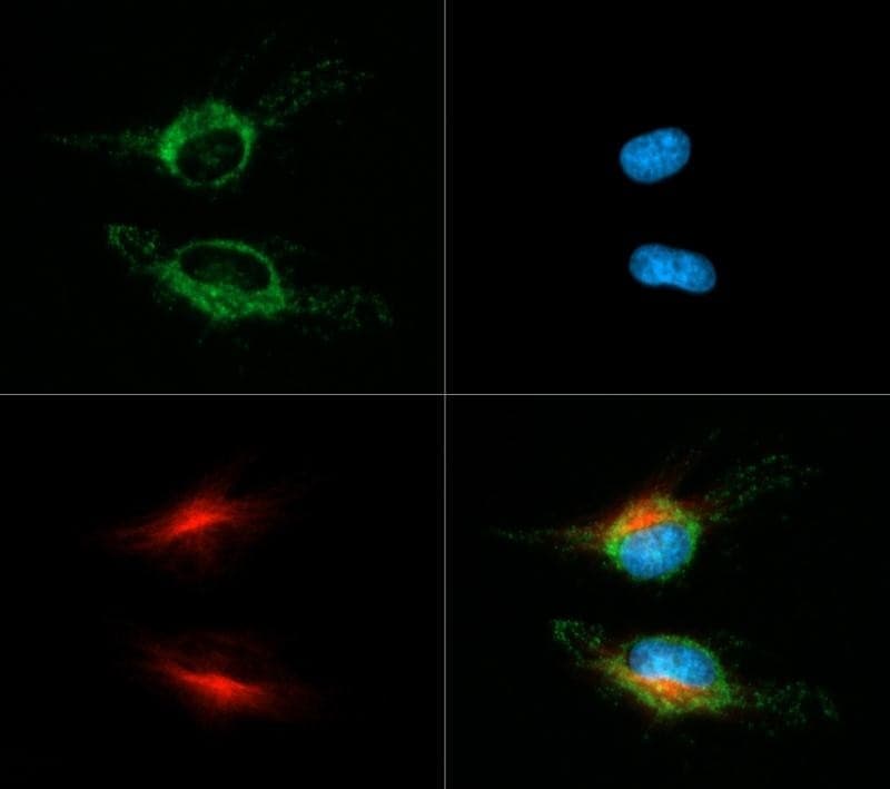 HSPD1 / HSP60 Antibody