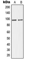 Polyclonal Rabbit anti-Human GIT1 Antibody (C-Terminus, IHC, WB)