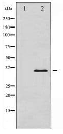 Polyclonal Rabbit anti-Human NFKBIA / IKB Alpha / IKBA Antibody (WB)