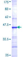 Human CHST1 Protein (Recombinant GST, N-terminus)