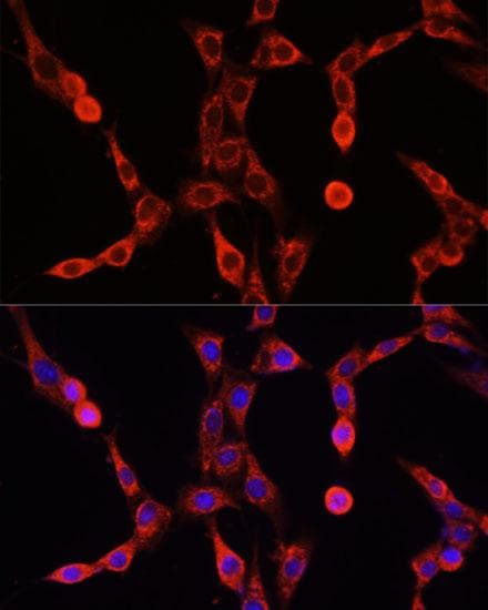 ALDP / ABCD1 Antibody