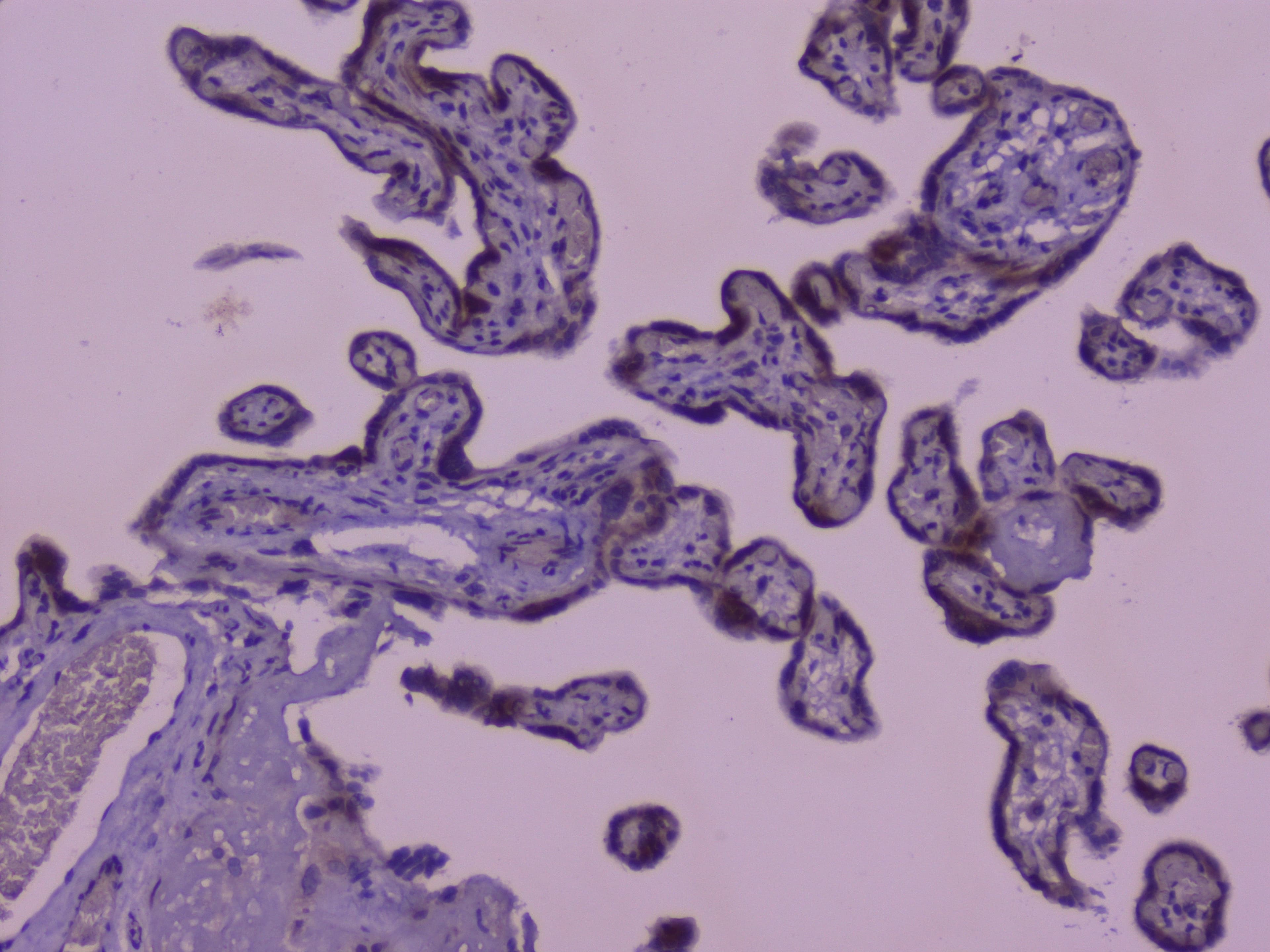 Polyclonal Rabbit anti-Human Capicua / CIC Antibody (IHC)