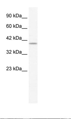 PHKG2 Antibody (N-Terminus)