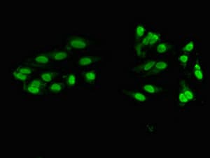 Polyclonal Rabbit anti-Human ZNF331 Antibody (aa179-442, IHC, IF)