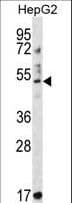 Polyclonal Rabbit anti-Human TRIM11 Antibody (aa300-329, IHC, WB)
