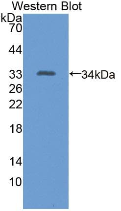 EML2 / EMAP2 Antibody (aa1-273)