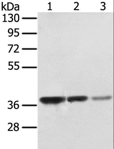 STX16 / Syntaxin 16 Antibody