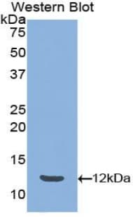 Peptide YY / PYY Antibody (aa30-98)