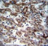 GCD / GCDH Antibody (aa336-365)