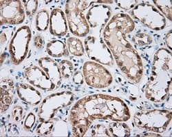 BTK Antibody (clone OTI15G8)