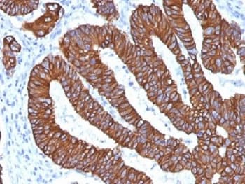 Cytokeratin 8+18 Antibody (clone KRT8.18/1346, Azide-free, BSA-free)