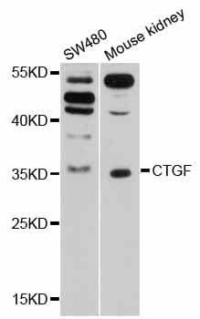 CTGF Antibody