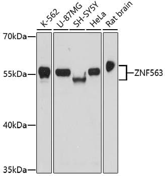 Polyclonal Rabbit anti-Human ZNF563 Antibody (WB)