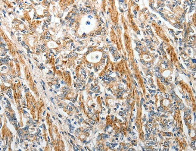 SELE / CD62E / E-selectin Antibody