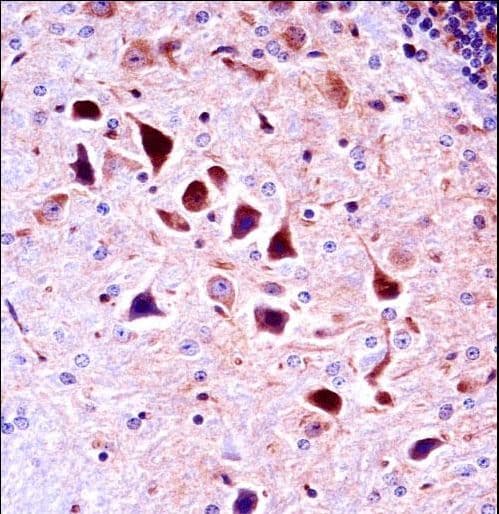 NTRK3 / TRKC Antibody (aa161-188)