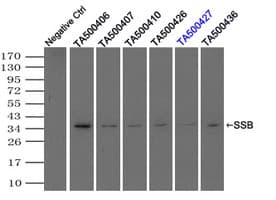 Monoclonal Mouse anti-Human SSB / La Antibody (clone OTI6G7, IHC, IF, WB)