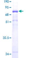 Human ERP44 Protein (Recombinant GST)