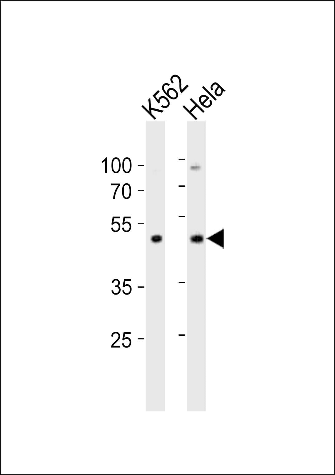 BAF53 / ACTL6A Antibody (aa295-320)